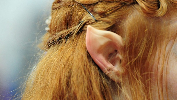 Elf ear - Chirurgie esthétique