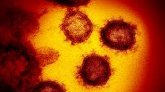 Etude : le coronavirus peut provoquer des lésions neurologiques