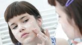 Cicatrices d'acné : conseils et solutions pour s'en débarrasser