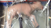 Un utérus artificiel en cours de test pour les grands prématurés