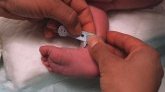 Inde : un bébé naît avec un troisième bras
