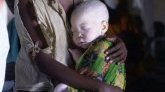 Un enfant albinos de 4 ans enlevé et sauvagement tué au Burundi 